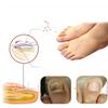 Comprehensive Nail Care Treatment South Moon Targets Yellow Nails Ingrown Nails