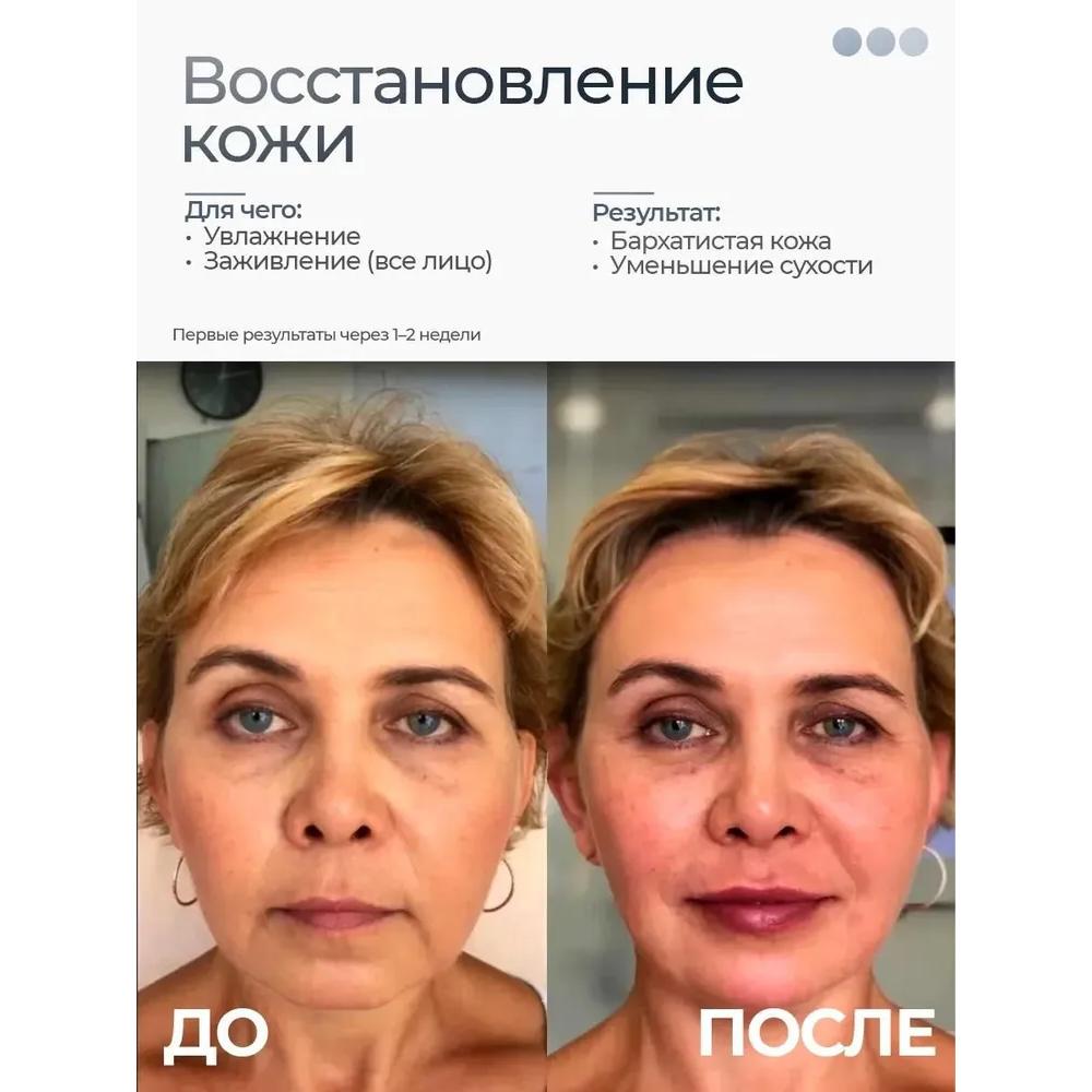 Micro facial massager, RF elevator, micro massager