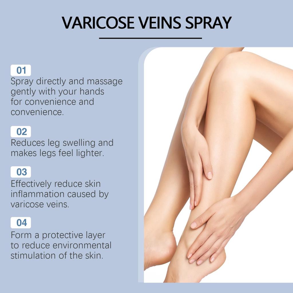 A Varicose Veins To Soothe The Leg, A Quick Leg Spray30ml