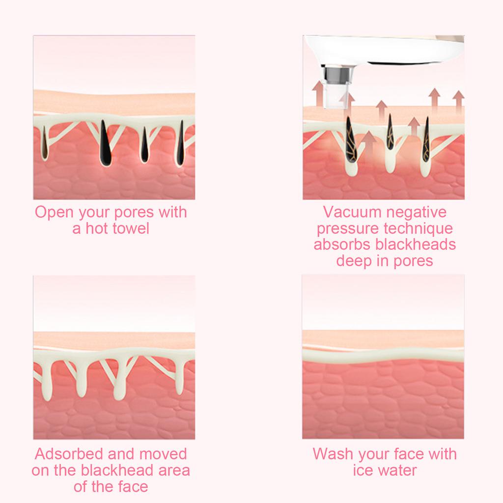 Electric Blackhead Removal Machine 3 Strength Deep Cleansing Skin Pores Vacuum Cleaner White