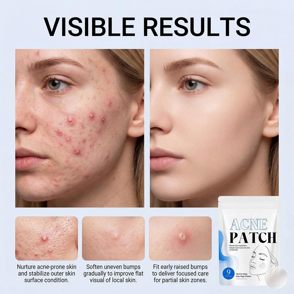 Microneedle Patches, 9 Packs Dissolving Pimple Patches for Face, Overnight Stickers with Hydrocolloid, Zit Patches for Blemishes