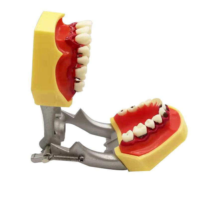 Periodontal Practice Model for Subgingival Scaling and Doctor-Patient Communication Other