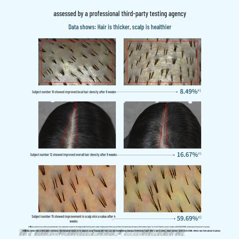 Fortro Anti-Hair Loss & Oil Control Shampoo