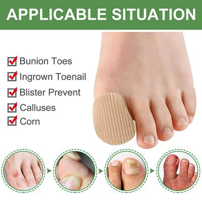 1 stuks Hallux Valgus Likdoorns Voetpijn Verlichting Orthopedische Inlegzolen Stof Siliconen Teenbuis Hoes Beschermer Vinger Tenen Scheiders