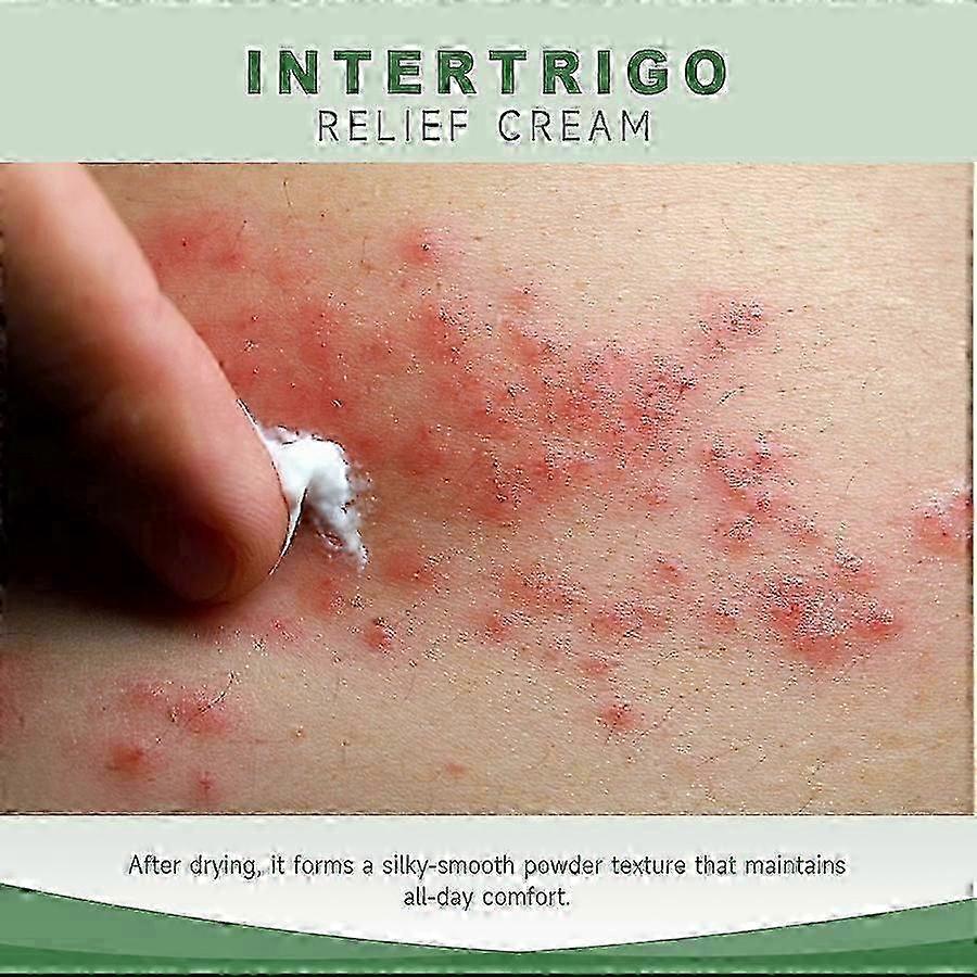 5x Intertrigo Cream Skin Fold Care & Chafing Support Cream Helps Soothe Irritated Skin NaixDC