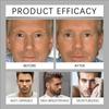 Men's -wrinkle Nourishing Cream Fades Fine Lines And Dry Lines Long-lasting Moisturizing Locks In Moisture Light Texture Non-sticky.