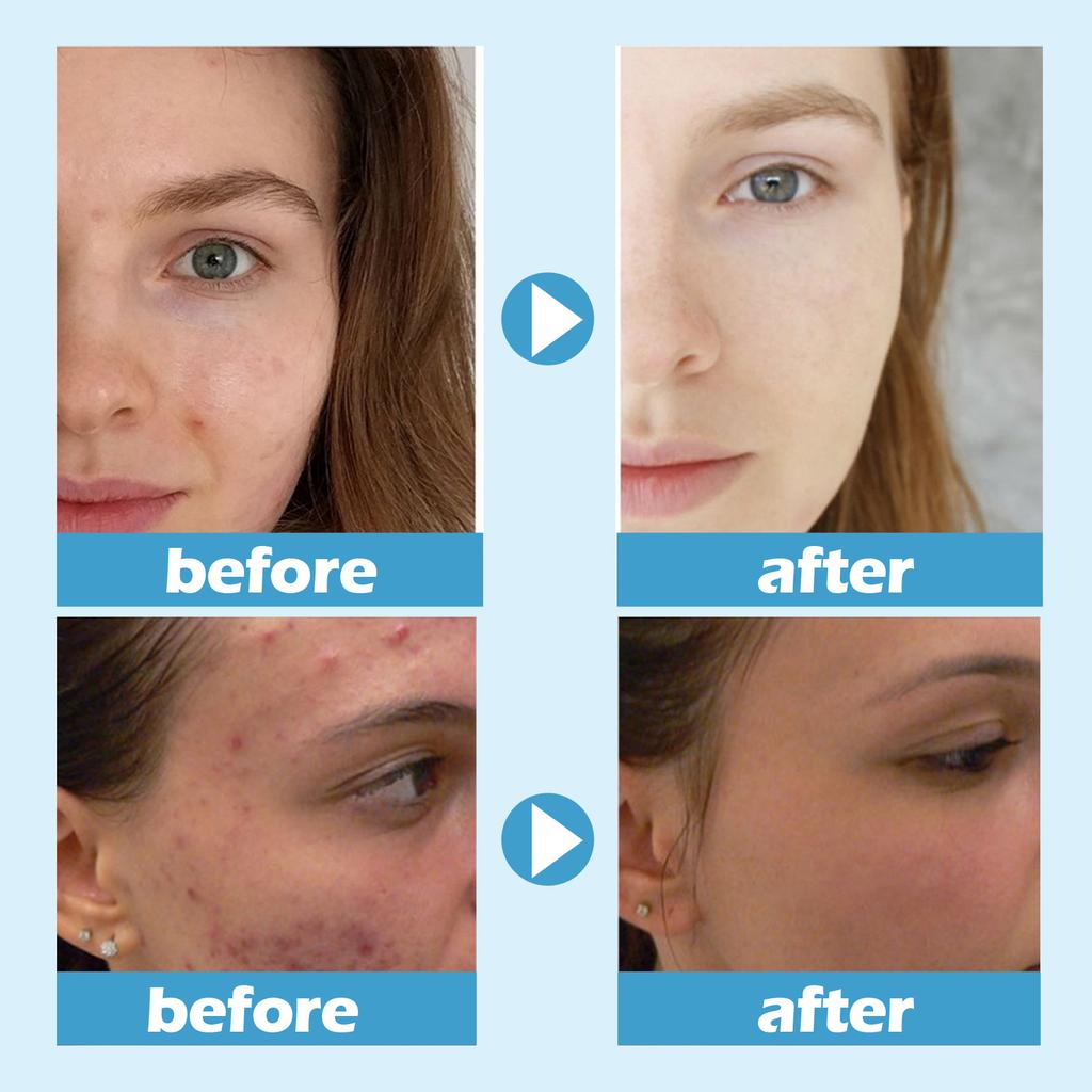 1ks JSkin Beauty Hydra Moist Ice Water Spací maska ​​pro ženy