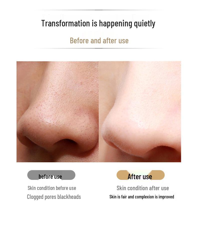 Red and Blue Light Ultrasonic Blackhead Remover & Photon Beauty Device