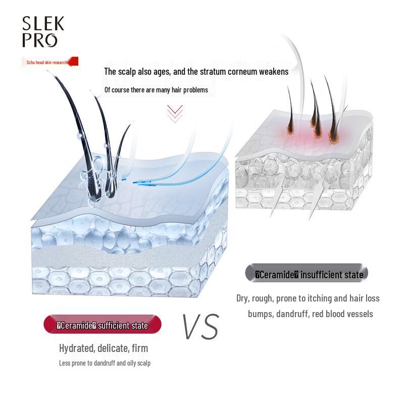 Shu Lei Scalp Refreshing Oil Control Anti-Dandruff Shampoo