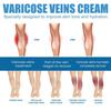 Yousheng 30ML Varicose Vein Massage Spray Relieve Leg Discomfort Improve Circulation Gentle Effective Varicose Spray