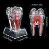 With Base Decomposable Dental Teeth Model Tooth Disintegration Ornaments  Practice Studying Tool