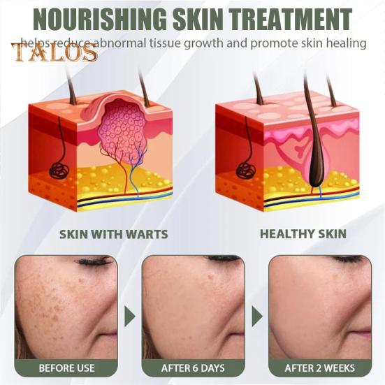 Instant Mole Spot Removal Gel Corrector Cream for All Skin Types Natural Extracts 50g Hydrating Gel Dark Spot Remover for Body Skin Repair Reduces