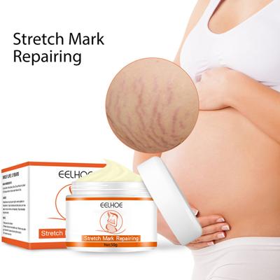 Cream Nourish Easy To Absorb Natural Safe Healthy Fade Scar Effective Stretch Mark