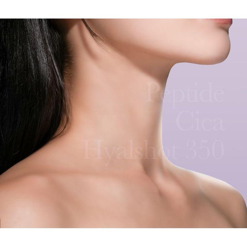 mixsoon - Peptide Cica Hyalshot 150