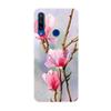 Voor ZTE Blade A7 2020 3GB 64GB Hoes Cover Zacht Siliconen Achterkant voor ZTE Blade A7S A7 2020 Vingerafdruk Hoesjes Schokbestendig Funda