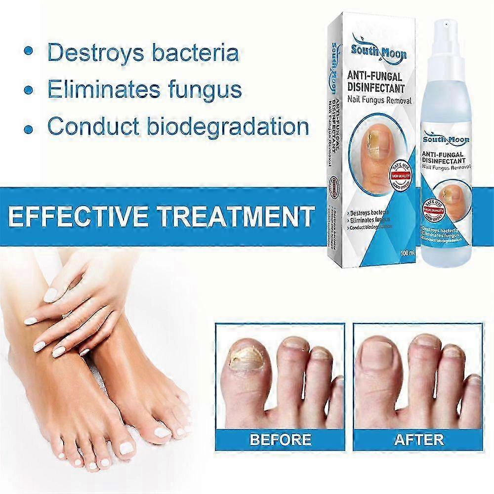 3pcs Nail Repair Spray 100ml, Repair Soften Thicken Nails, Clean Polish Nails, Professional Nail Care Treatment
