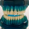 Hip Hop Star Shape Grillz Silver Gold Plated Single Teeth Grillz 18K Gold Plated Micro Pave Zircon Grillz