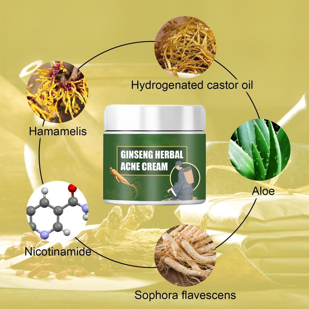 Effective Acne Removal Cream Treatment Acne Scar Shrink Pores Oil Control Whitening Moisturize Face