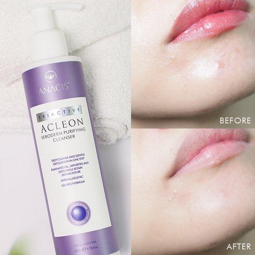 Acleon Anasis Mildly Alkaline Mildly Acidic Foam Cleansing 200ml
