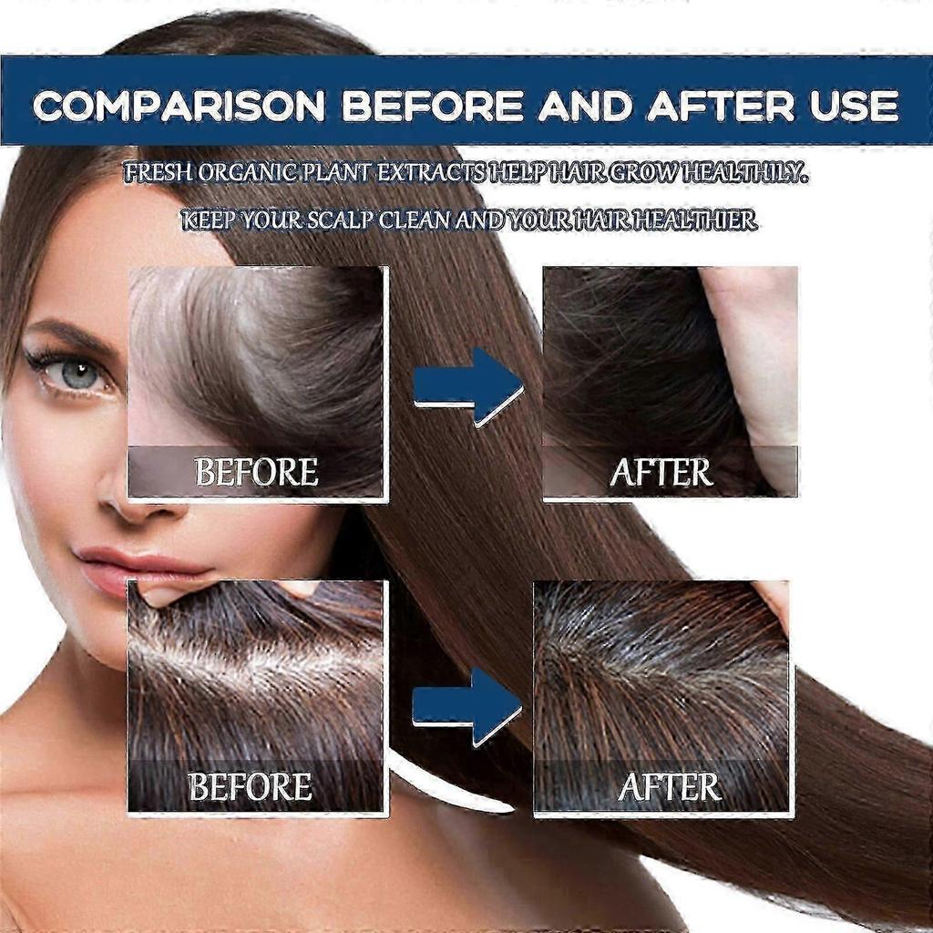 Hair Treatment Spray Moisturizes And Softens Hair, Prevents Loose Hair And Thickens Hair Treatment Spray