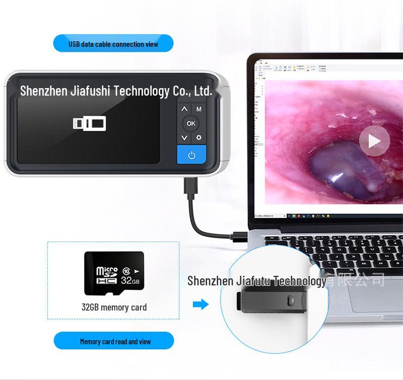 אוטוסקופ ויזואלי HD ואנדוסקופ להסרת שעוות אוזניים בגודל 4.5 אינץ'