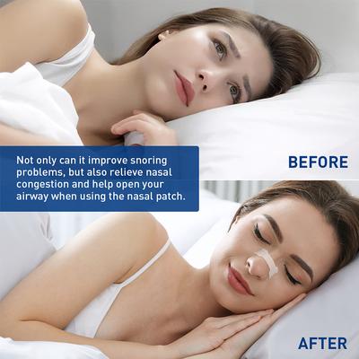 Nasal Strips for Snoring Nasal Patch Physical Expansion Breathable Nose Patch Better Sleep Anti-Snoring Extra Nasal Strip Patch