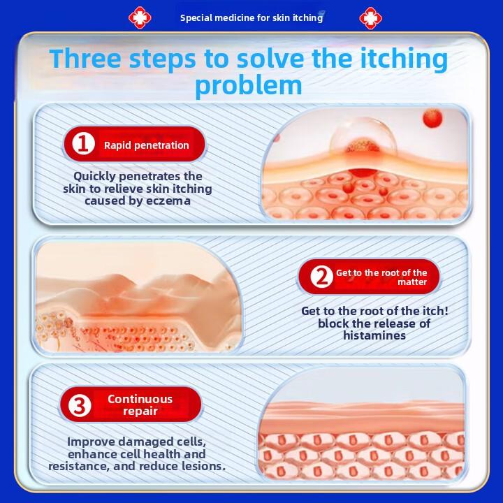 Anti-Itch Cream 50g Large Size, Fast Relief for Eczema, Fungal, Dermatitis & Skin Rashes, Antiseptic