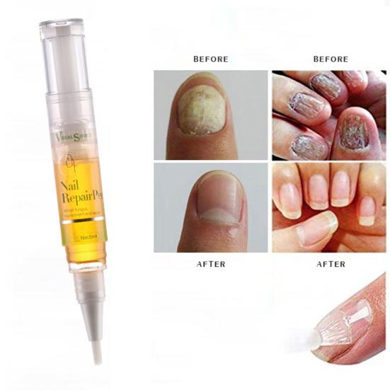 5ml Nail Repair Liquid Effective Fungus Removing Portable Pedicure Treatment Pen for Unisex