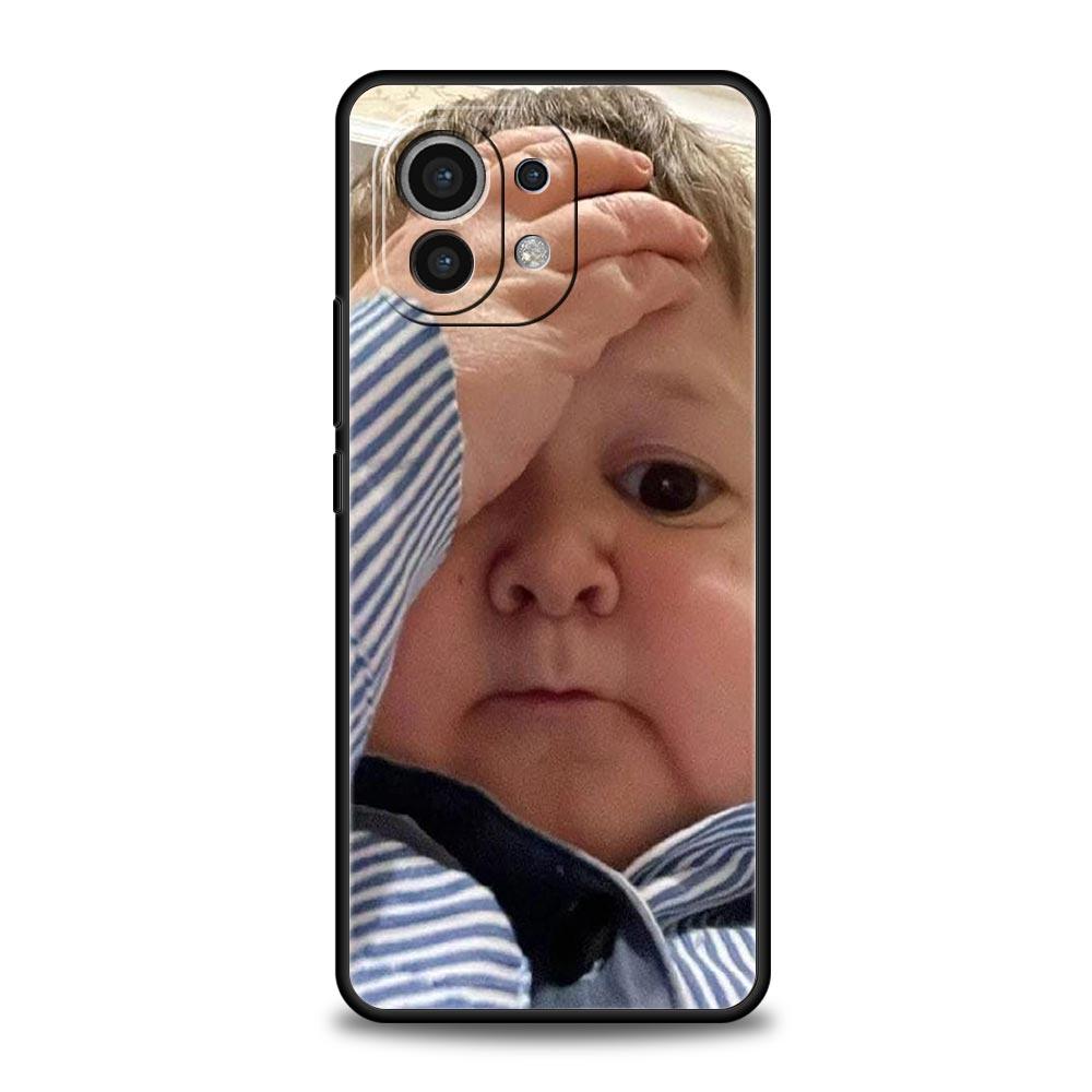 Funny Babaite Hasbulla Phone Case For Xiaomi Mi 17 15T 15 14 14T 13T 12T Pro 12 13 Lite 5G 11T Poco X6 X7 X5 Pro Soft Cover