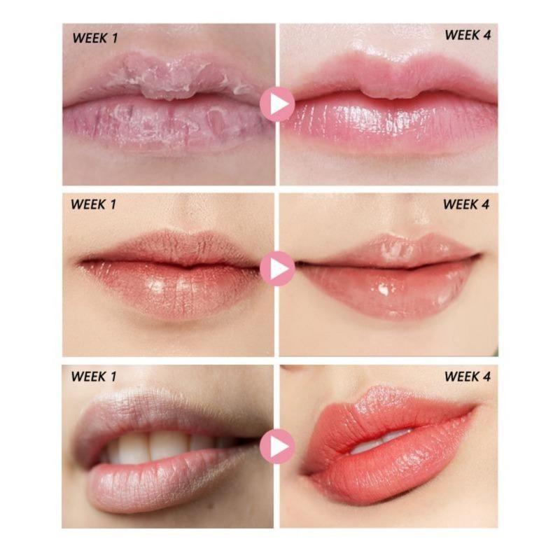 30g Peach Lip Scrub, Lightening Lip Lines, Hydrating, Exfoliating, Moisturizing Lip Scrub