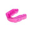 Mouth Guards & Trainers – Teeth Alignment Aids