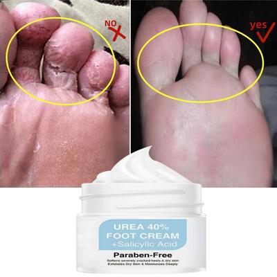 Pielęgnacja stóp Krem Mocznikowy Peeling Do Stóp Kwas Salicylowy Złuszcza Kalus Krem Nawilżający Naprawa Skóry Remover Martwy Naskórek Krem Do Stóp