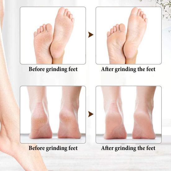 Electric Callus Remover 2-Speed Foot File for Dead Skin Hard & Cracked Heels Portable Pedicure Tool with 360 Degrees Roller Heads