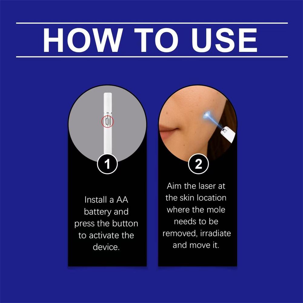 Newly Upgraded Blue Laser Pen for Skin Care, Gently Caring for Every Inch of Your Skin