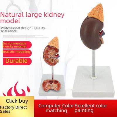Teaching Simulation Kidney Model: 1:1 Scale Adult Human Kidney Anatomical Structure