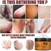 Foot Cream Heel Crack Repair Cream Dead Skin Removing Hand and Foot Care Moisturizing Cream