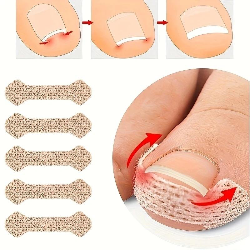 Zehennagel Korrektur Patch Nagel Erholung Zehenpflege Werkzeug Nagelwerkzeug Korrektur Pediküre Werkzeugset