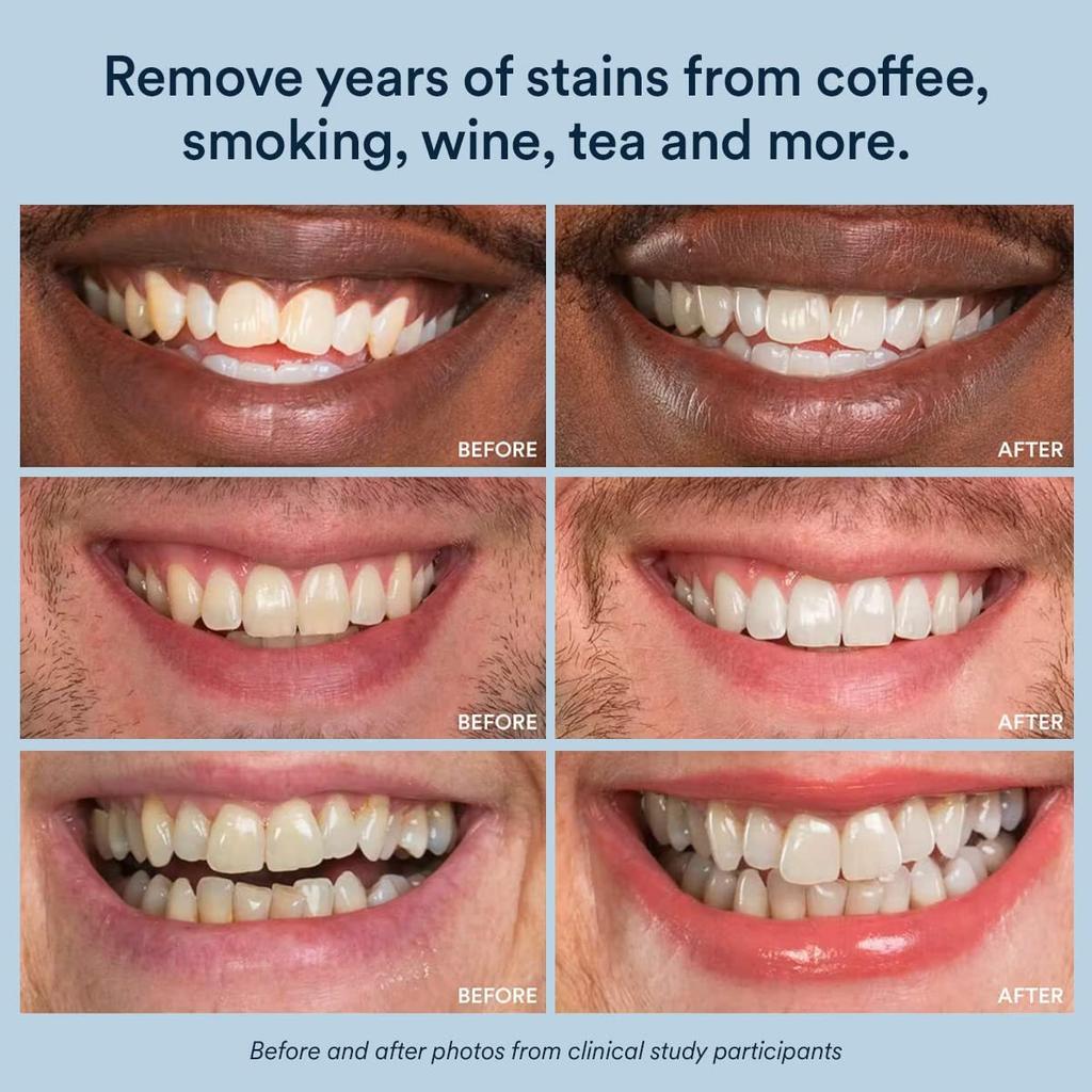 Teeth Whitening Strips 14 Treatments, Enamel Safe for Instant White Smile, Easy To Apply Tooth Whitening Kit with 28 Strips (14 Upper & 14 Lower)