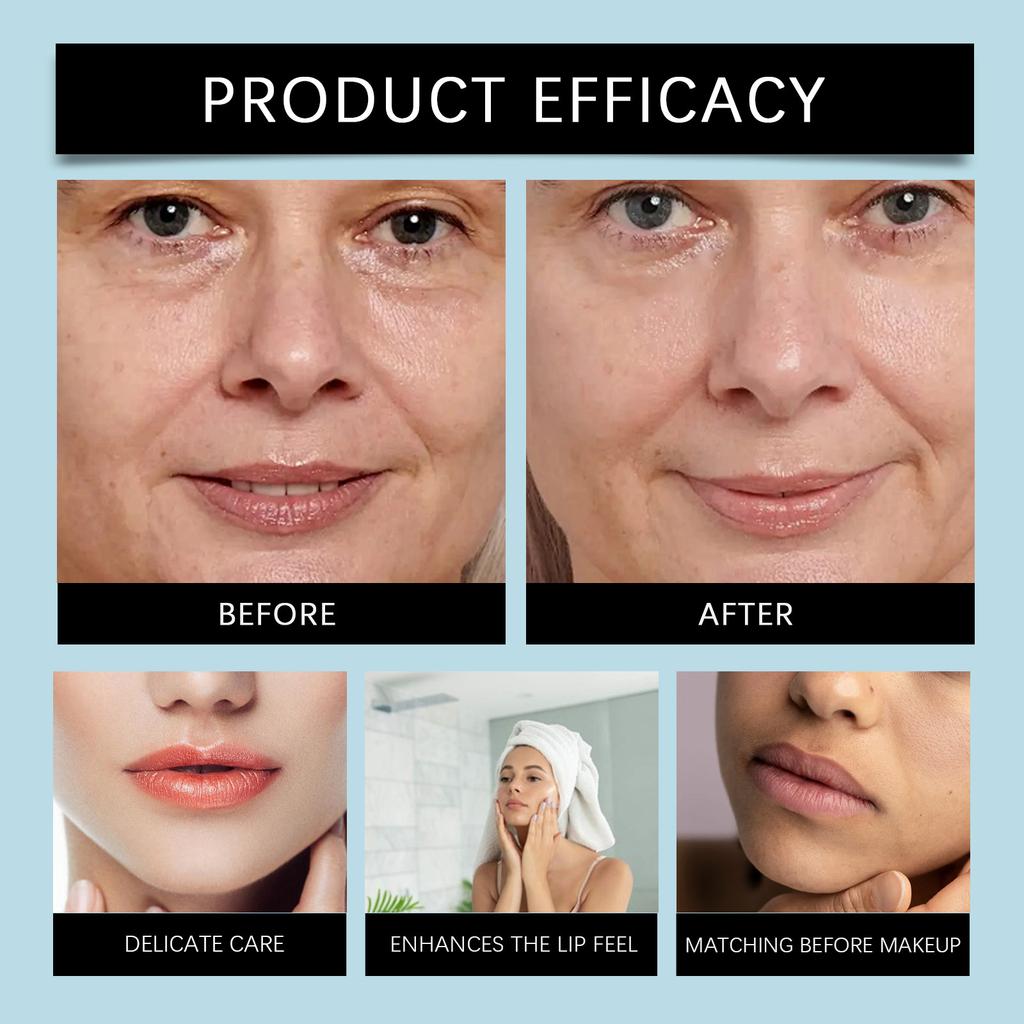 Lip Wrinkle Removal Patch Facial Smile Line Smoothing Fine Lines Wrinkle Patch Suitable For A Variety Of Lip Shapes.