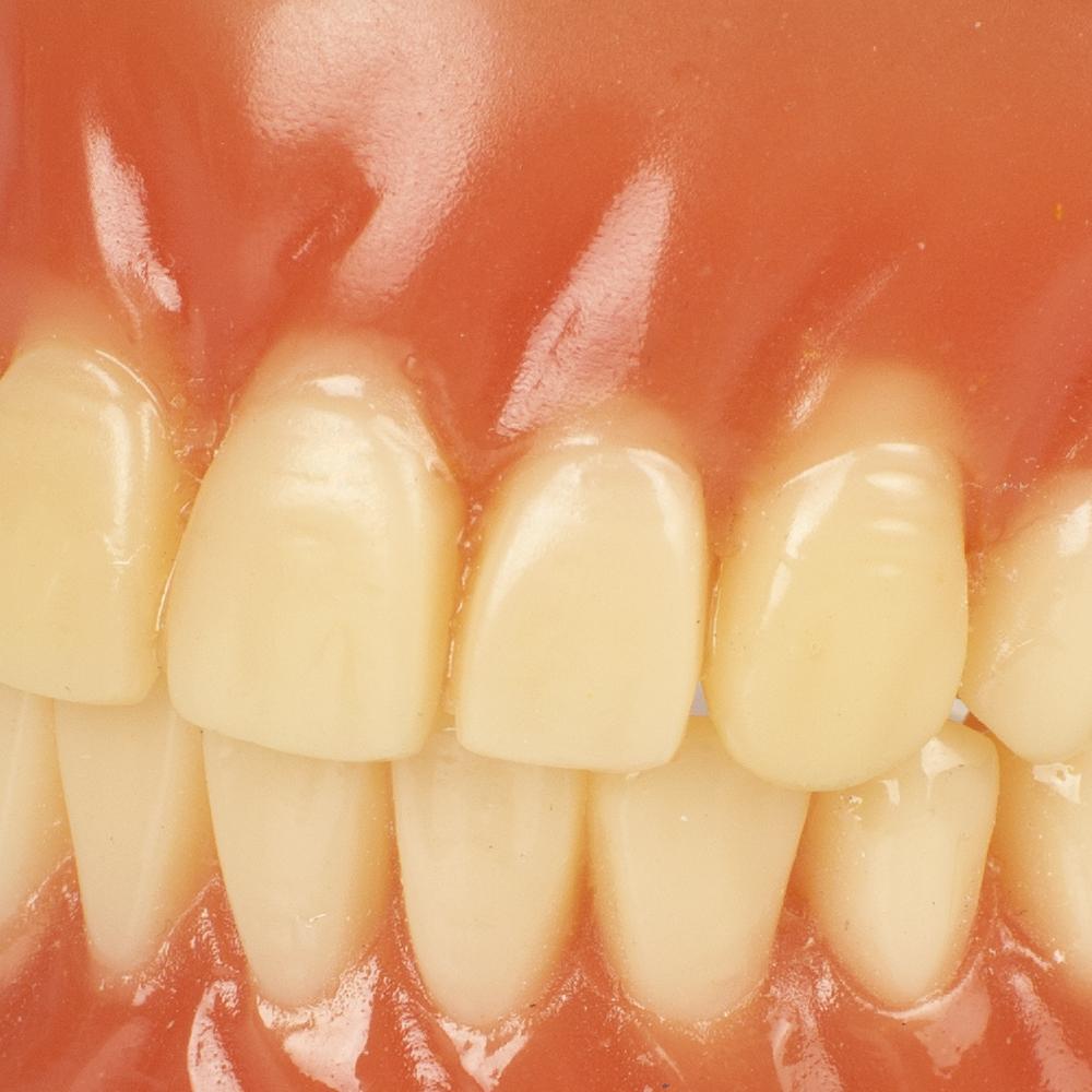 Modèle de dents de démonstration Standard pour adultes, étude d'enseignement dentaire