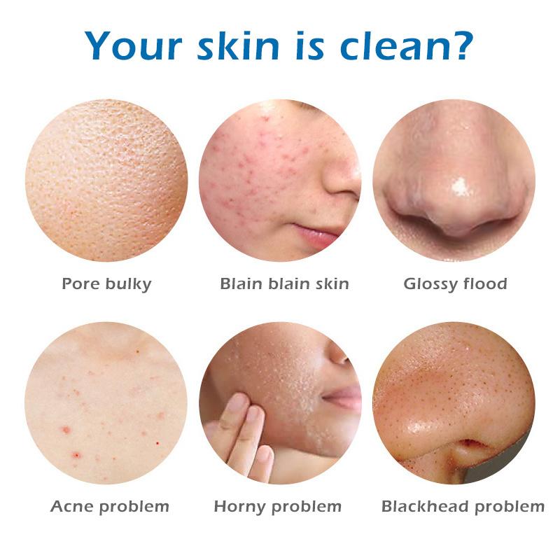 100g Meersalz Seife Reiniger Entfernung Pickel Poren Akne Behandlung Ziegenmilch Feuchtigkeitsspendende Gesichtswaschseife Basis Hautpflege