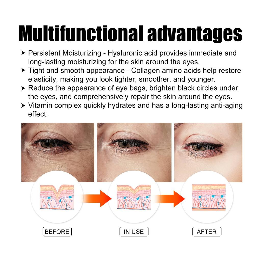 Eye Gel, Eye Gel With Natural Marine Collagen And Hyaluronic To Reduce Eye Puffiness And Dark Circles, AntiAging Eye Gel For Face, 12 Count 10ml