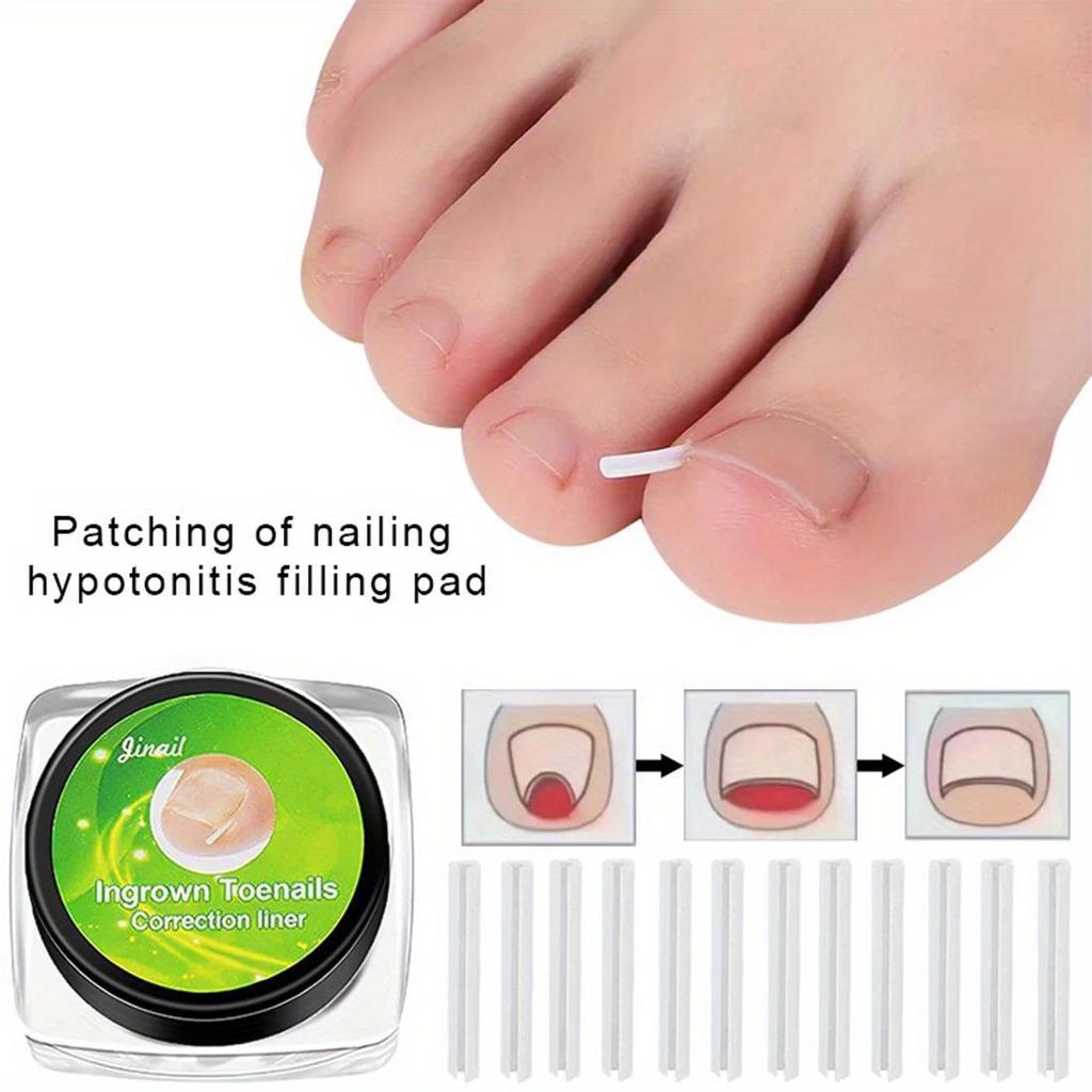 10Pcs Toenail Straightening Clippers Toenail Correction Tools Set Nail Care Elastic Stickers Pedicure Foot Care Tools