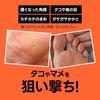Scratch Corn Sole Exfoliation Foot Hard Callus Corn Removal Heel Stick Hand Callus