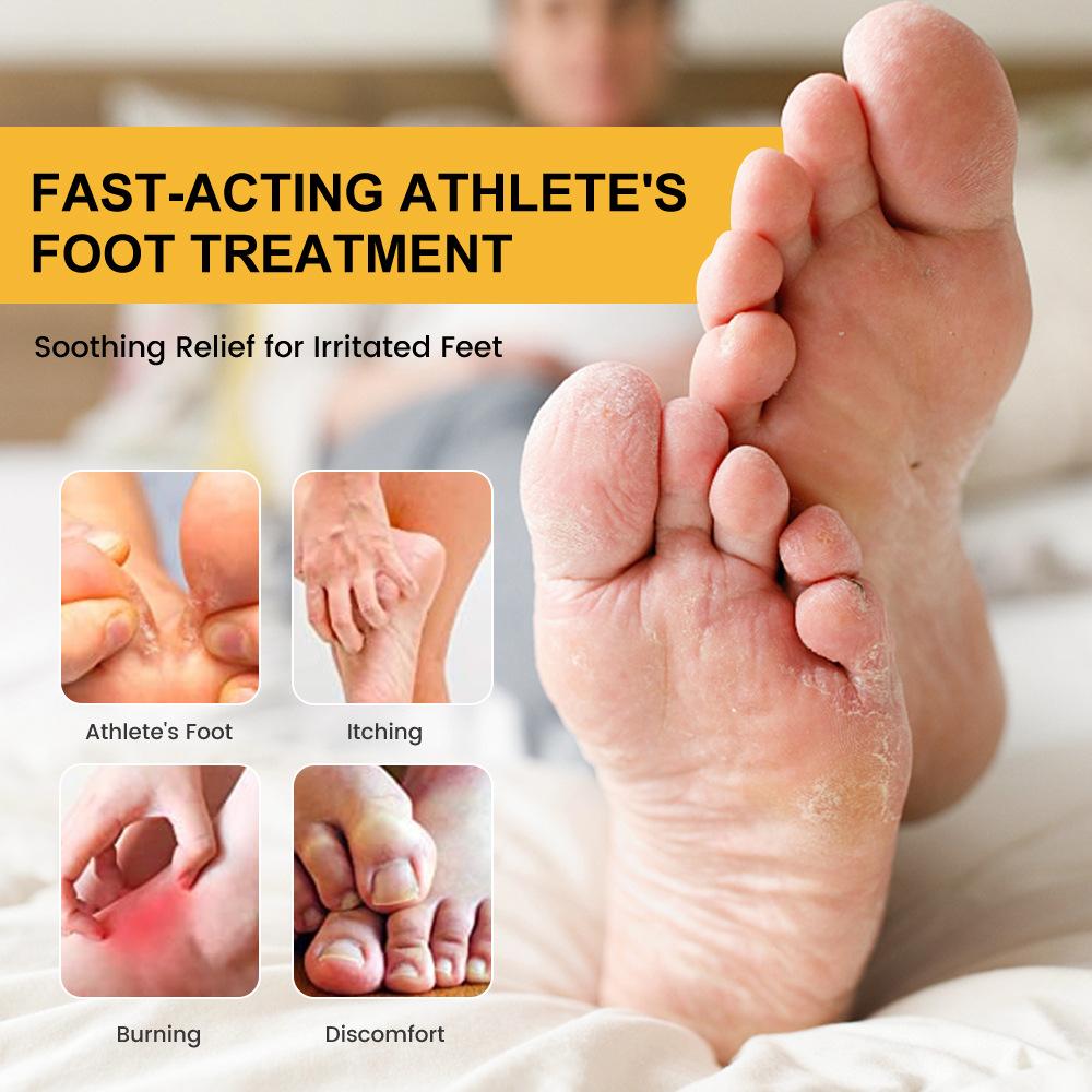 Sumifun 20/40/100 ML Foot Odor Care Cream Bee Relieves Redness and Swelling Soothing Itchy Feet Effectively Summer Home Essential
