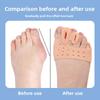 Double-hole Thumb Eversion Toe Splitter with Hole Foot Thickening Shock Absorption Massage Forefoot Pad Big Foot Orthopedic Cover