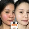 Face Creams for Women  Whitening Cream for Dark Skin Skin Whitening Cream