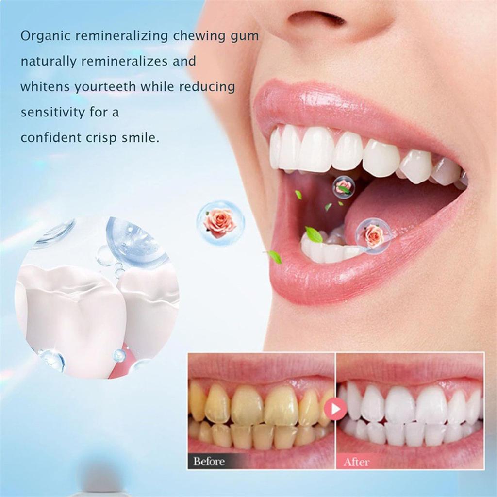Smile Oral Mouthwash,  Mouthwash, Oral Mouthwash, Foam Toothpaste Teeth Total Care 100g