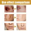60Pcs Forehead Wrinkle Patches Smoothening Eyes Non Silicone Face Tape for All Skin Types