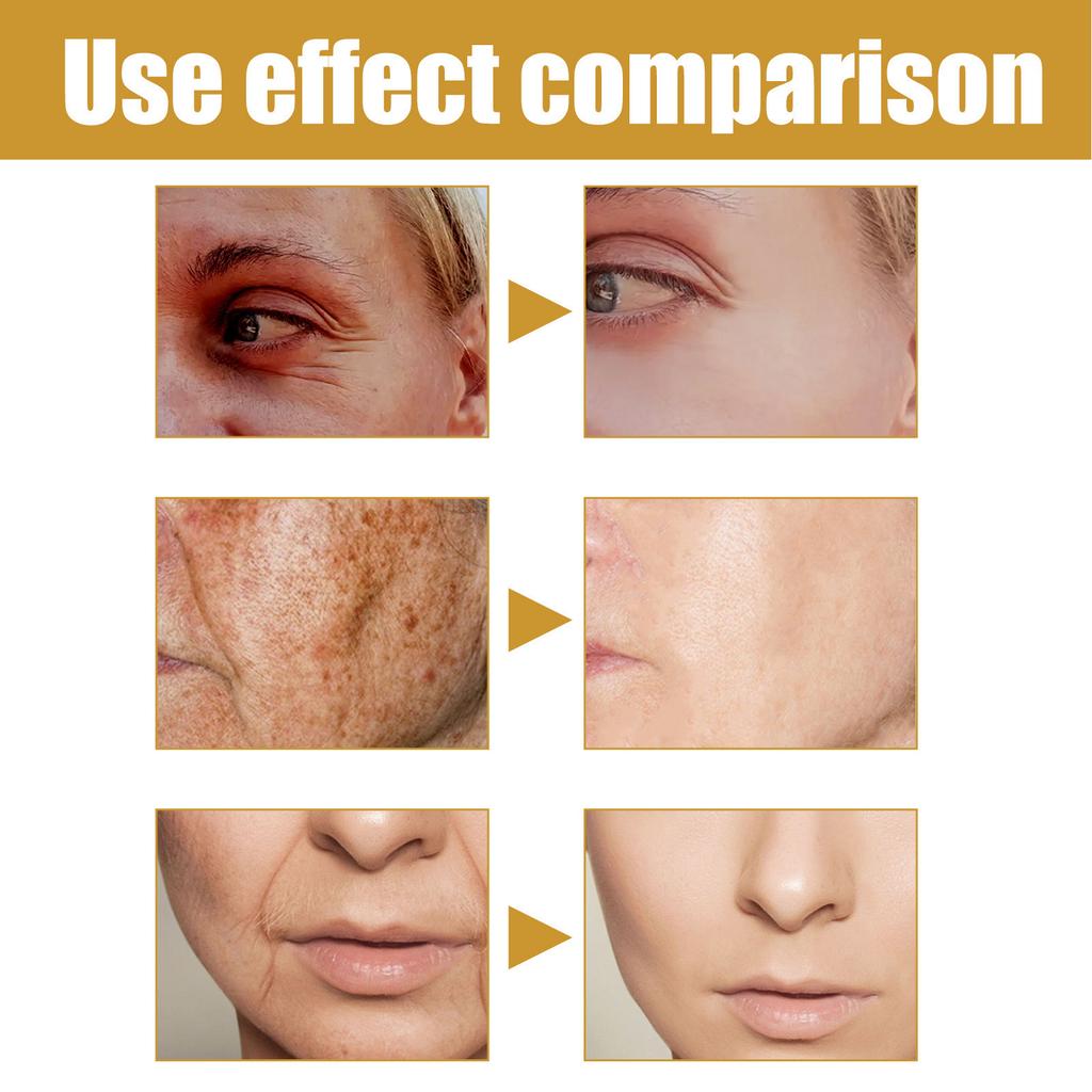 60Pcs Forehead Wrinkle Patches Smoothening Eyes Non Silicone Face Tape for All Skin Types